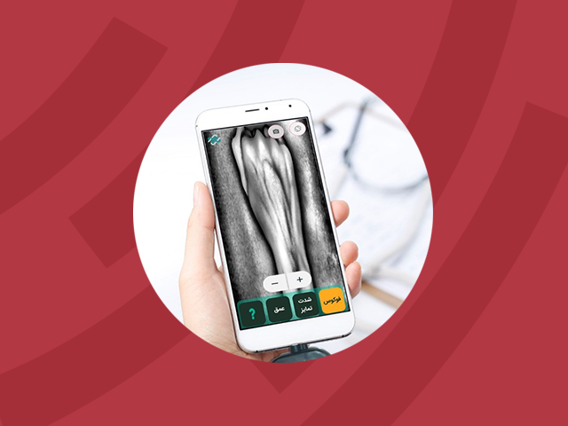 فناوران دانشگاه آزاد موفق به ساخت دستگاه رگ‌یاب موبایلی شدند